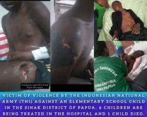 WP westpapua,folter,vertreibung und massenmord